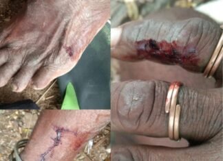 వరంగల్ పోలీస్ కమిషనరేట్ పరిధిలో దాడి